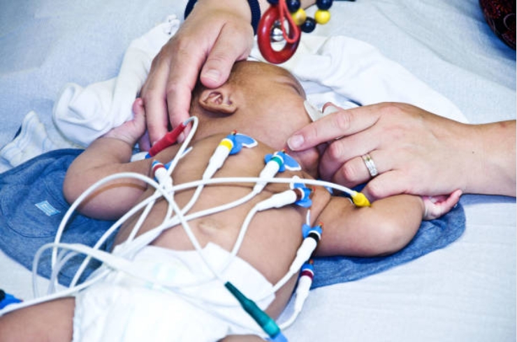 Congenital Heart Defects------16